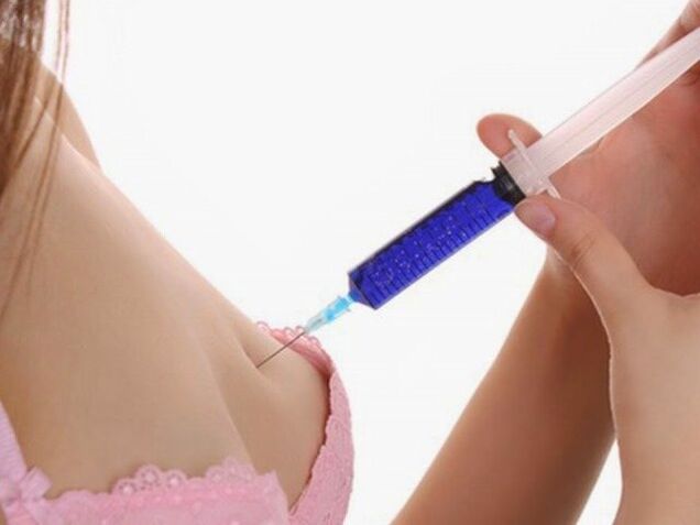 injekcije hialuronske kisline za povečanje prsi