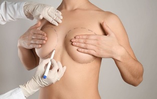 metode povečanja dojk s kirurškim posegom