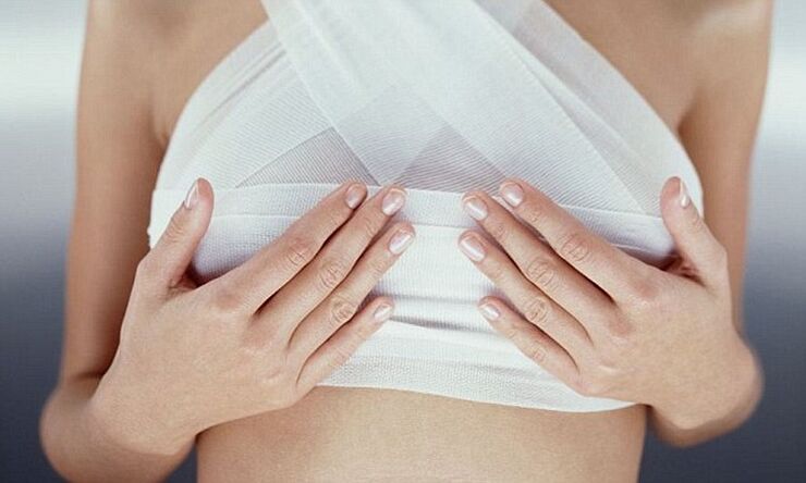 bandažirane dojke po operaciji povečanja prsi